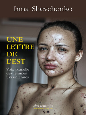 cover image of Une lettre de l'Est